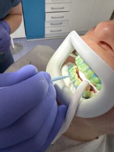 Ordinacijsko beljenje zuba u „Smile Time“ ordinaciji – osmeh koji traje 