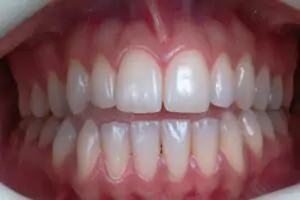 savršeno zdravi zubi uz smile time zubnu ordinaciju 