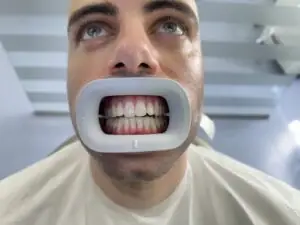 Nesvakidašnja priča o beljenju zuba u ordinaciji „Smile Time“ Novi Sad