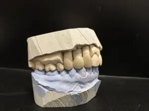 cirkonijum krunice novi sad 