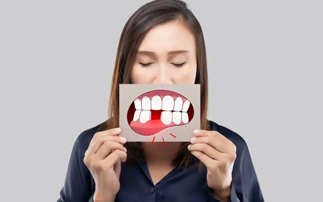 Šta se dešava kada izgubimo jedan zub?