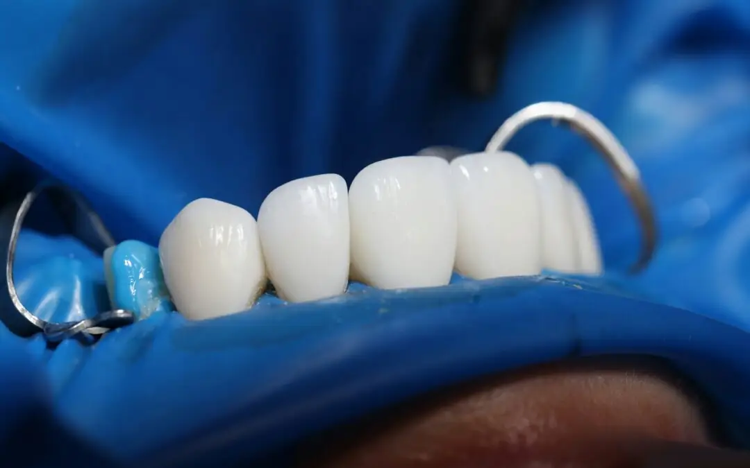 Privremeni rad nakon implantata